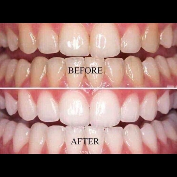 Teeth whitening toothpaste - Picture 2 of 2